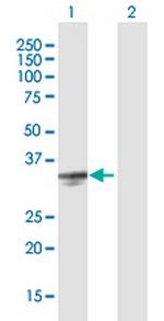 PRSS21 Antibody in Western Blot (WB)