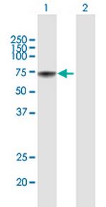 METAP2 Antibody in Western Blot (WB)