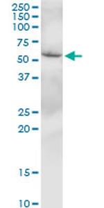 SLC38A3 Antibody in Western Blot (WB)