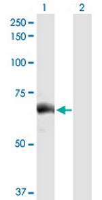 SLC27A5 Antibody in Western Blot (WB)