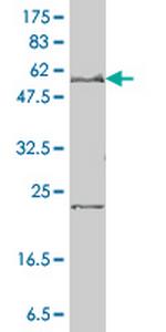 SLC27A4 Antibody in Western Blot (WB)