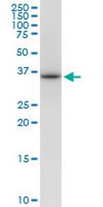 VAX1 Antibody in Western Blot (WB)