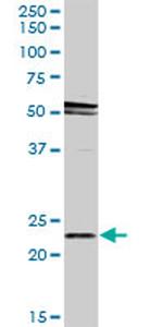 RAB31 Antibody in Western Blot (WB)