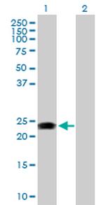 RAB31 Antibody in Western Blot (WB)