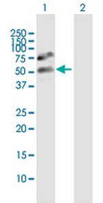 GTF2A1L Antibody in Western Blot (WB)