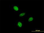 ALF Antibody in Immunocytochemistry (ICC/IF)