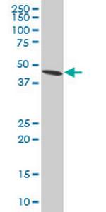 ADRM1 Antibody in Western Blot (WB)