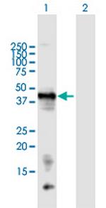 LECT1 Antibody in Western Blot (WB)