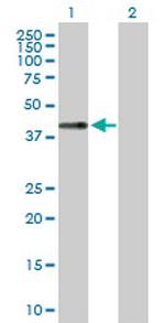 LECT1 Antibody in Western Blot (WB)