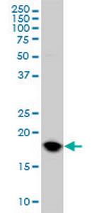 UBE2C Antibody in Western Blot (WB)