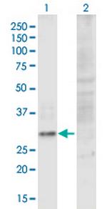 C10orf10 Antibody in Western Blot (WB)