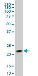 STMN2 Antibody in Western Blot (WB)