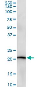 STMN2 Antibody in Western Blot (WB)