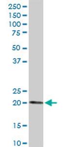 ESM1 Antibody in Western Blot (WB)