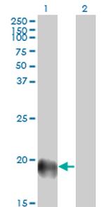 ESM1 Antibody in Western Blot (WB)