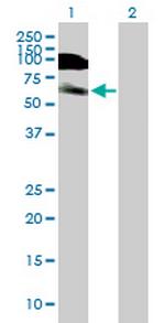 DIDO1 Antibody in Western Blot (WB)