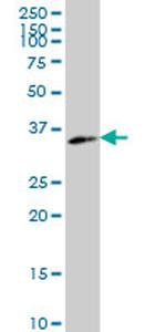 WDR5 Antibody in Western Blot (WB)