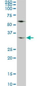 WDR5 Antibody in Western Blot (WB)