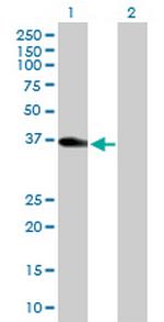 KATNA1 Antibody in Western Blot (WB)