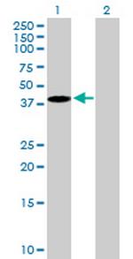 EMILIN1 Antibody in Western Blot (WB)