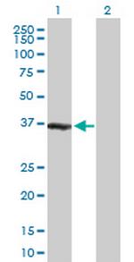 ZWINT Antibody in Western Blot (WB)