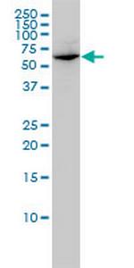 GLMN Antibody in Western Blot (WB)