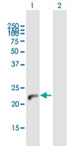 NUDT4 Antibody in Western Blot (WB)