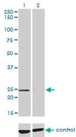 NUDT5 Antibody in Western Blot (WB)