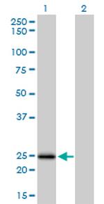 NUDT5 Antibody in Western Blot (WB)