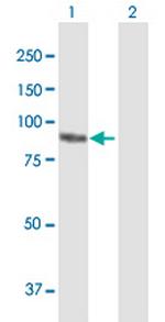 PKP3 Antibody in Western Blot (WB)