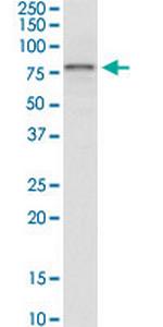 IRAK3 Antibody in Western Blot (WB)