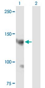 AKAP13 Antibody in Western Blot (WB)