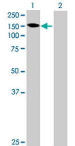 GALNT6 Antibody in Western Blot (WB)