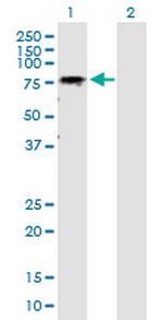 GALNT6 Antibody in Western Blot (WB)