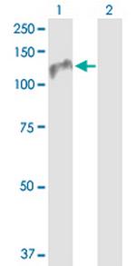 ZHX1 Antibody in Western Blot (WB)