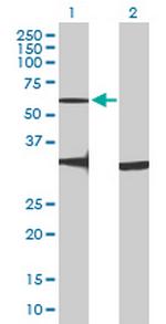 GPR176 Antibody in Western Blot (WB)