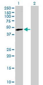 TREX1 Antibody in Western Blot (WB)