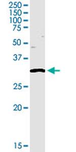 TREX1 Antibody in Western Blot (WB)