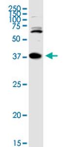 TREX1 Antibody in Western Blot (WB)