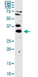 TREX1 Antibody in Western Blot (WB)