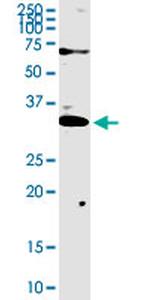 TREX1 Antibody in Western Blot (WB)