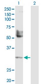 TREX1 Antibody in Western Blot (WB)