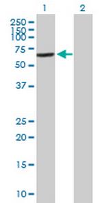 VPS45 Antibody in Western Blot (WB)