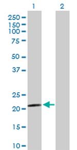 PARK7 Antibody in Western Blot (WB)