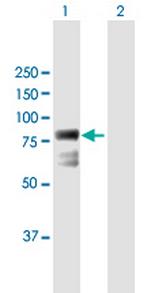 ECD Antibody in Western Blot (WB)