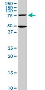 HSGT1 Antibody in Western Blot (WB)