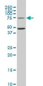 HSGT1 Antibody in Western Blot (WB)