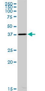 ACOT7 Antibody in Western Blot (WB)