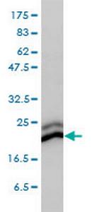 CBX3 Antibody in Western Blot (WB)