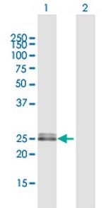 OIP5 Antibody in Western Blot (WB)